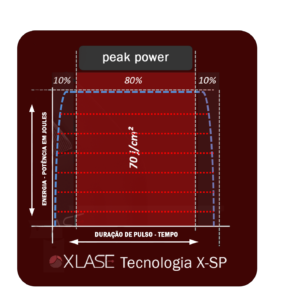Tecnologia X-SP XLASE 